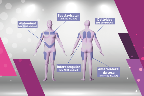 Curso para Curso de Hipodermóclise